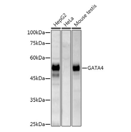 Western Blot - Anti-GATA4 Antibody [ARC51718] (A305425) - Antibodies.com