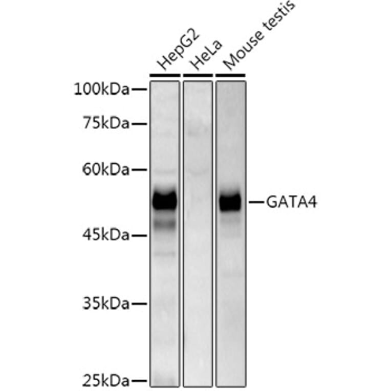 Western Blot - Anti-GATA4 Antibody [ARC51718] (A305425) - Antibodies.com