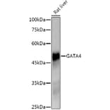 Western Blot - Anti-GATA4 Antibody [ARC51718] (A305425) - Antibodies.com