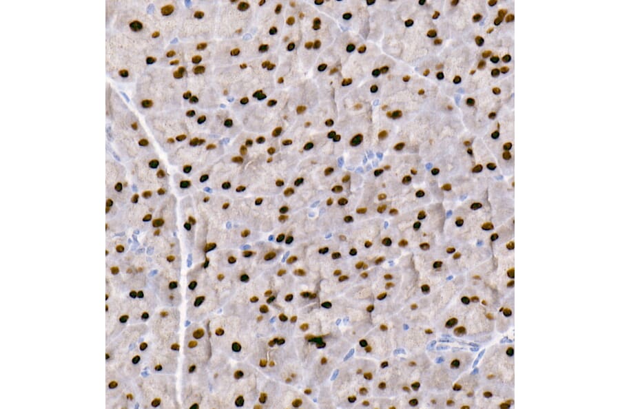 Immunohistochemistry - Anti-GATA4 Antibody [ARC51718] (A305425) - Antibodies.com