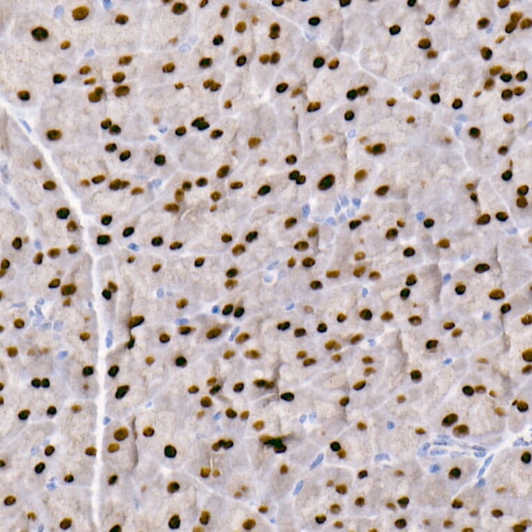 Immunohistochemistry - Anti-GATA4 Antibody [ARC51718] (A305425) - Antibodies.com