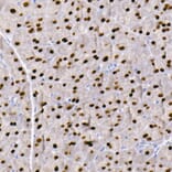Immunohistochemistry - Anti-GATA4 Antibody [ARC51718] (A305425) - Antibodies.com