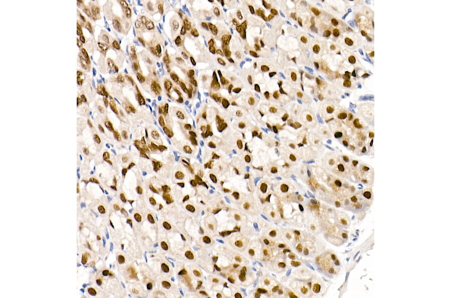 Immunohistochemistry - Anti-GATA4 Antibody [ARC51718] (A305425) - Antibodies.com