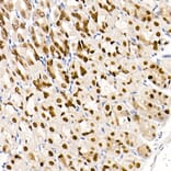 Immunohistochemistry - Anti-GATA4 Antibody [ARC51718] (A305425) - Antibodies.com