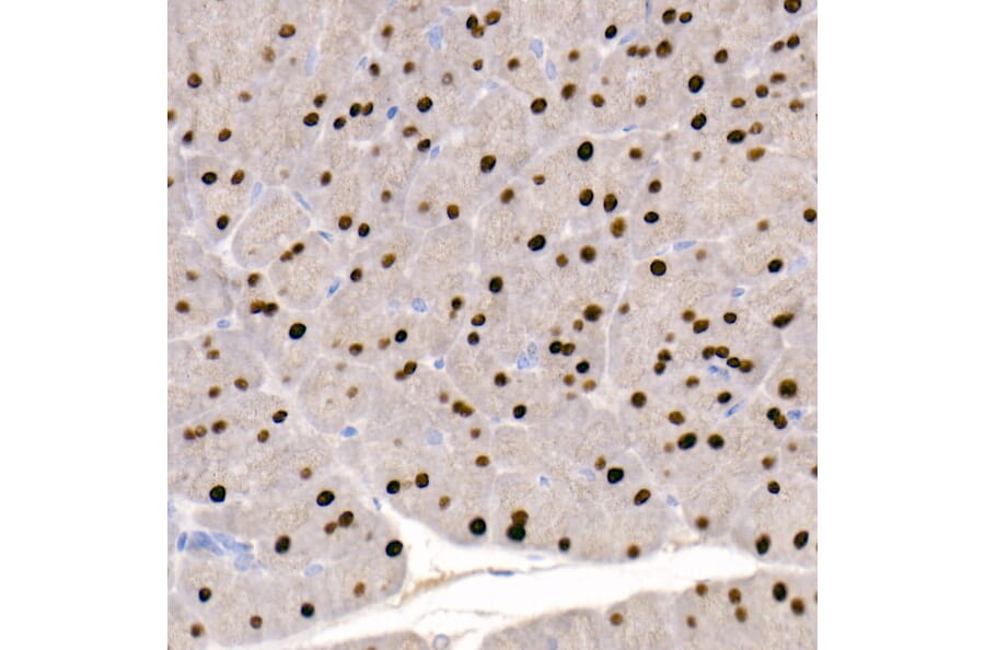 Immunohistochemistry - Anti-GATA4 Antibody [ARC51718] (A305425) - Antibodies.com