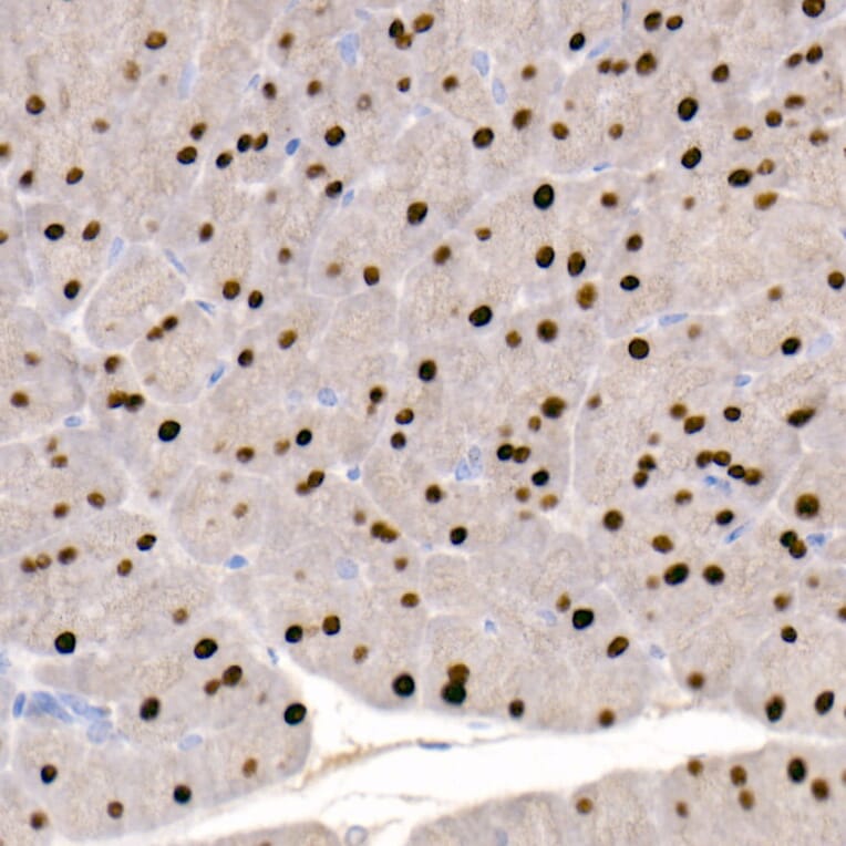 Immunohistochemistry - Anti-GATA4 Antibody [ARC51718] (A305425) - Antibodies.com