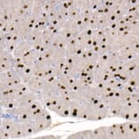 Immunohistochemistry - Anti-GATA4 Antibody [ARC51718] (A305425) - Antibodies.com