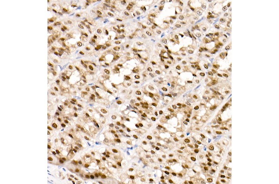 Immunohistochemistry - Anti-GATA4 Antibody [ARC51718] (A305425) - Antibodies.com
