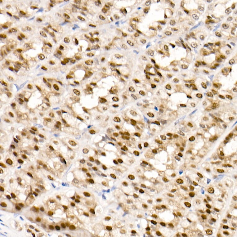 Immunohistochemistry - Anti-GATA4 Antibody [ARC51718] (A305425) - Antibodies.com