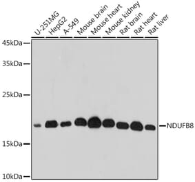 Western Blot - Anti-NDUFB8 Antibody (A305426) - Antibodies.com