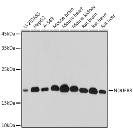 Western Blot - Anti-NDUFB8 Antibody (A305426) - Antibodies.com