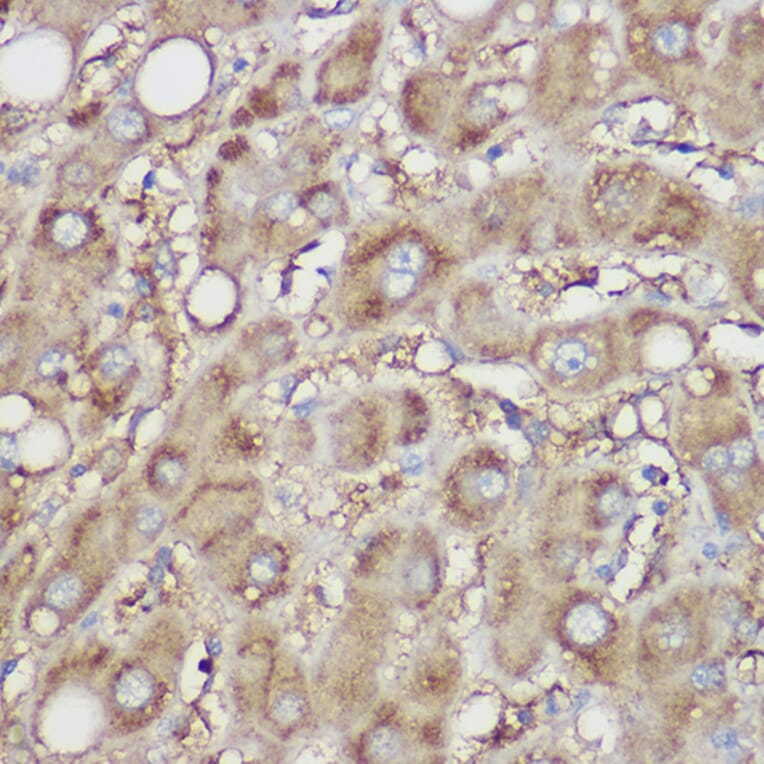 Immunohistochemistry - Anti-NDUFB8 Antibody (A305426) - Antibodies.com