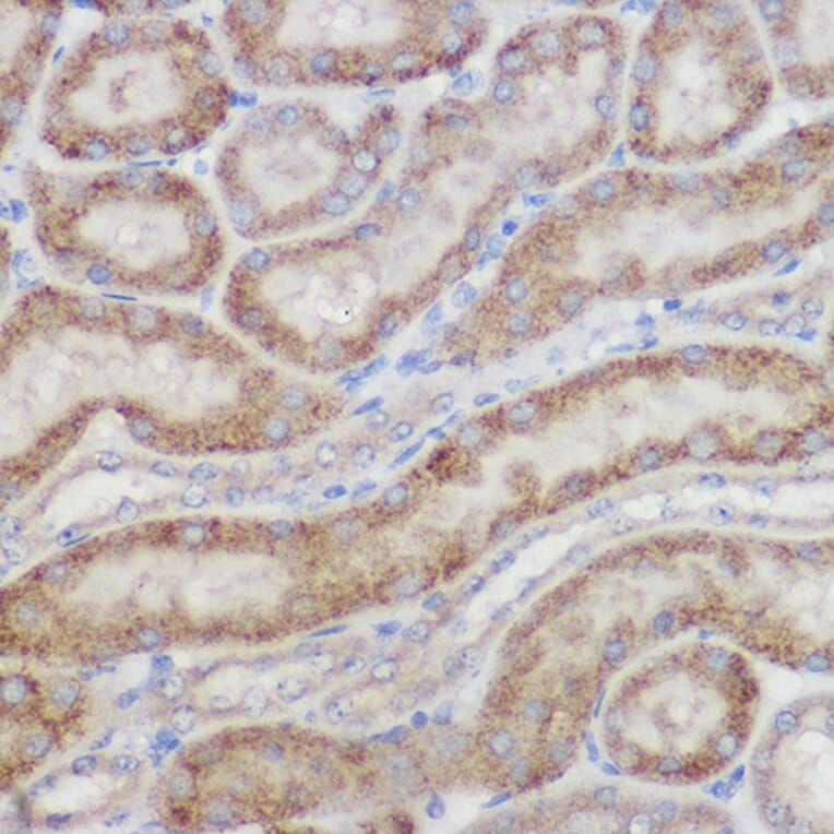 Immunohistochemistry - Anti-NDUFB8 Antibody (A305426) - Antibodies.com