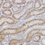 Immunohistochemistry - Anti-NDUFB8 Antibody (A305426) - Antibodies.com