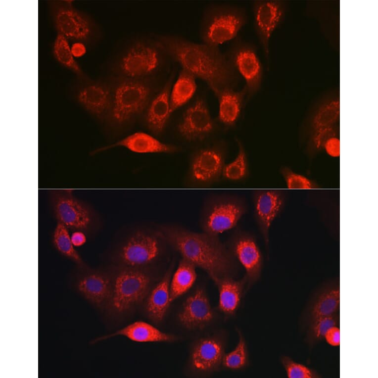 Immunofluorescence - Anti-NDUFB8 Antibody (A305426) - Antibodies.com