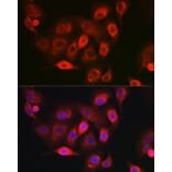 Immunofluorescence - Anti-NDUFB8 Antibody (A305426) - Antibodies.com
