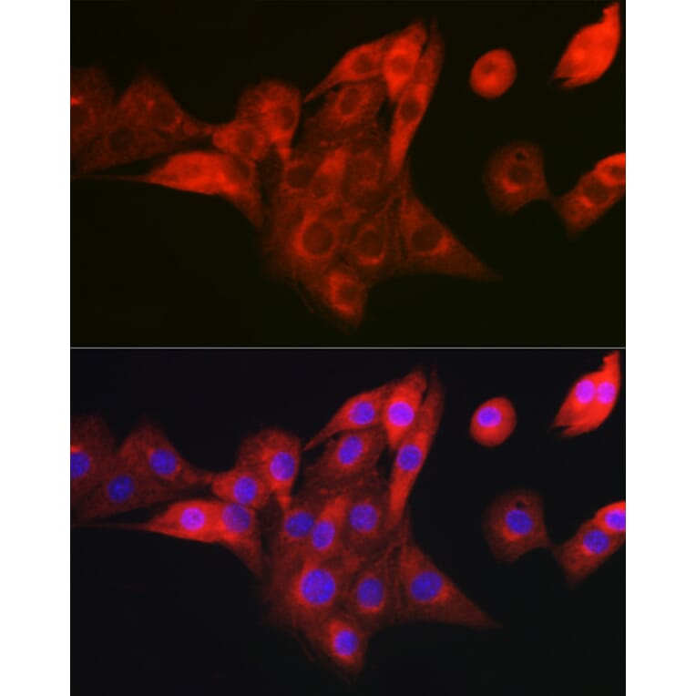 Immunofluorescence - Anti-NDUFB8 Antibody (A305426) - Antibodies.com