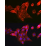 Immunofluorescence - Anti-NDUFB8 Antibody (A305426) - Antibodies.com