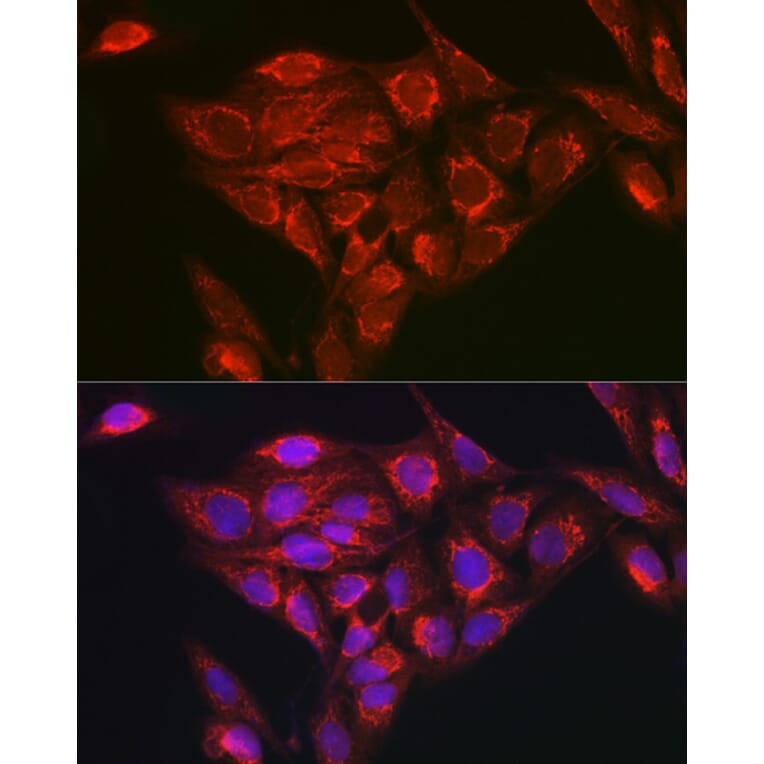Immunofluorescence - Anti-NDUFB8 Antibody (A305426) - Antibodies.com