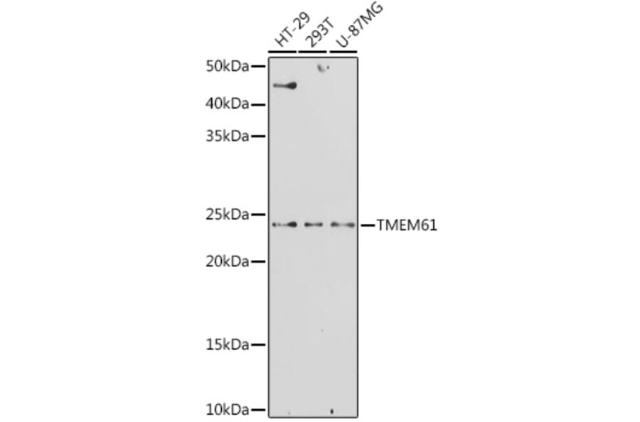 Western Blot - Anti-TMEM61 Antibody (A305427) - Antibodies.com