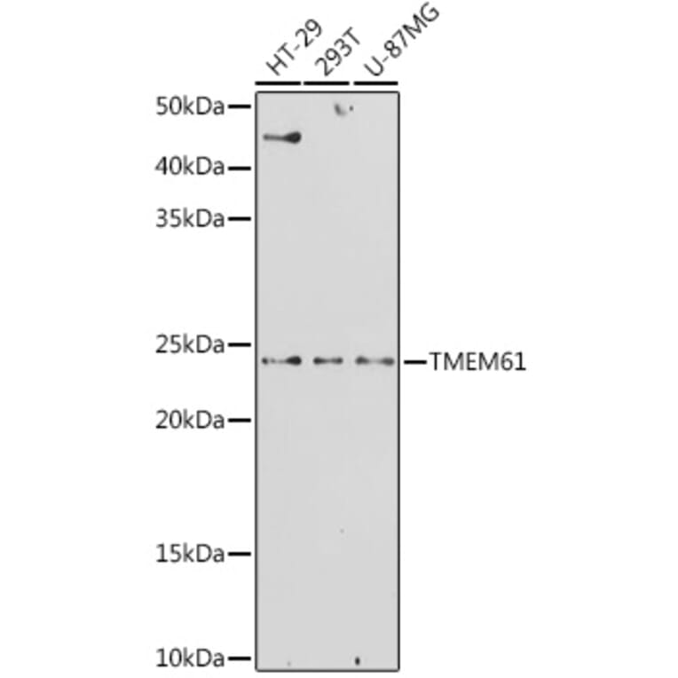 Western Blot - Anti-TMEM61 Antibody (A305427) - Antibodies.com