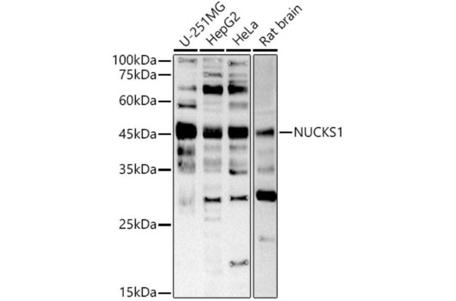 Western Blot - Anti-NUCKS1 Antibody (A305428) - Antibodies.com