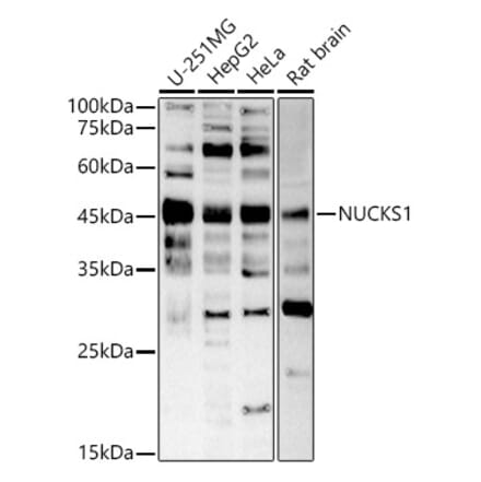 Western Blot - Anti-NUCKS1 Antibody (A305428) - Antibodies.com