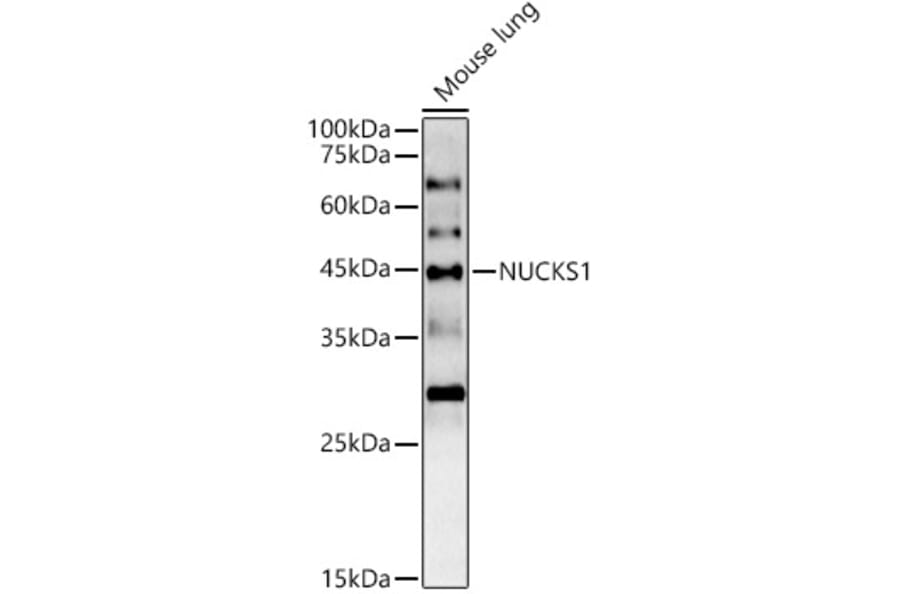 Western Blot - Anti-NUCKS1 Antibody (A305428) - Antibodies.com