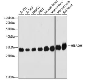 Western Blot - Anti-HIBADH Antibody (A305430) - Antibodies.com