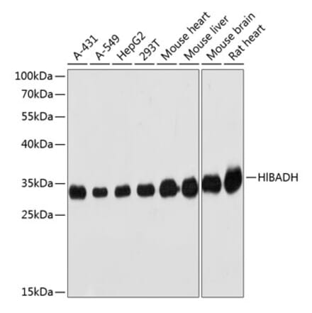 Western Blot - Anti-HIBADH Antibody (A305430) - Antibodies.com