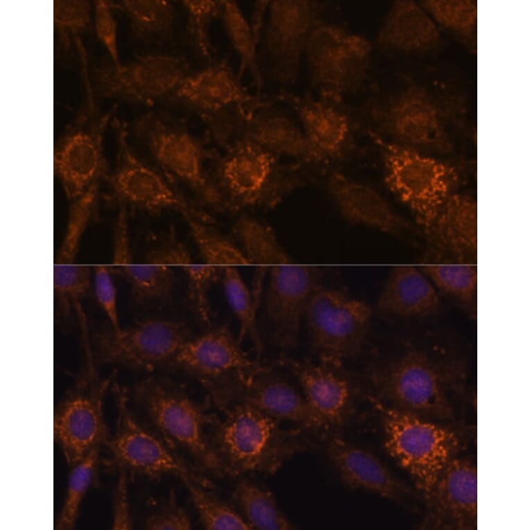 Immunofluorescence - Anti-HIBADH Antibody (A305430) - Antibodies.com