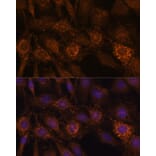 Immunofluorescence - Anti-HIBADH Antibody (A305430) - Antibodies.com