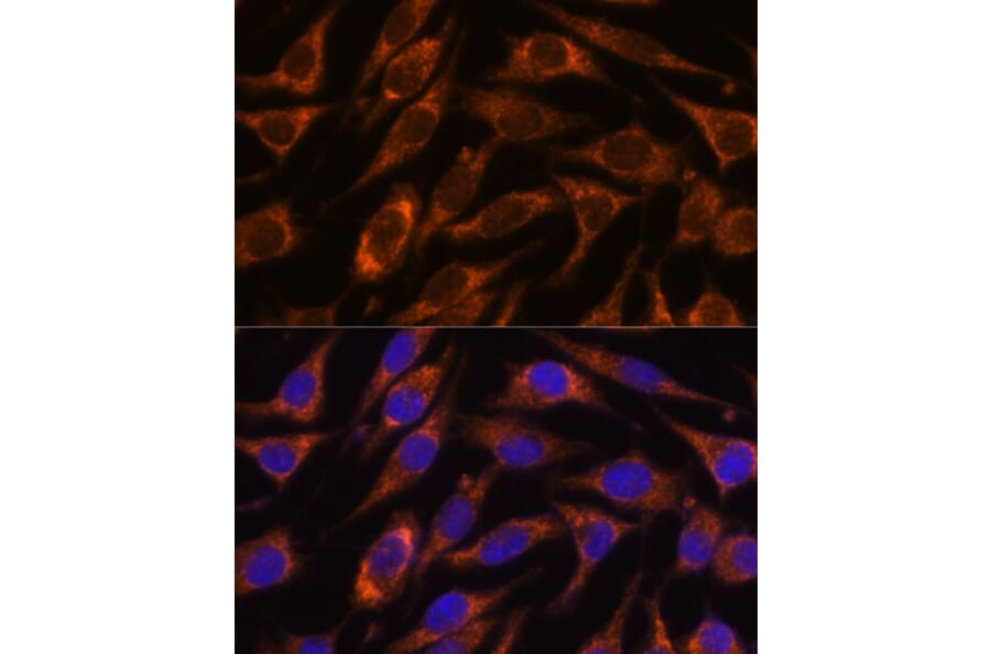 Immunofluorescence - Anti-HIBADH Antibody (A305430) - Antibodies.com