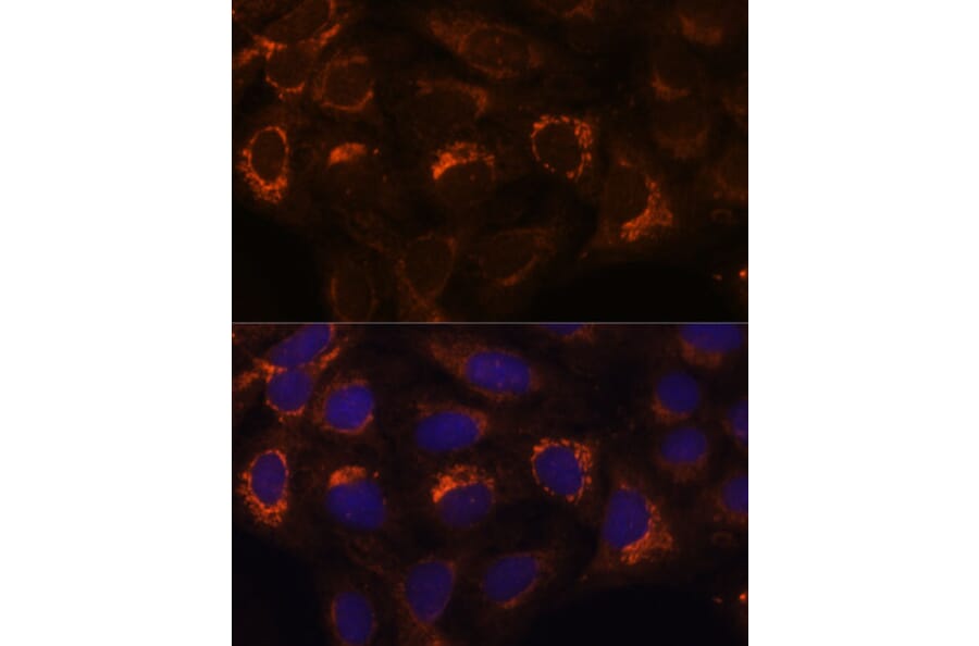 Immunofluorescence - Anti-HIBADH Antibody (A305430) - Antibodies.com