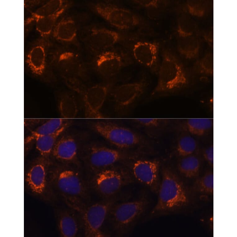 Immunofluorescence - Anti-HIBADH Antibody (A305430) - Antibodies.com