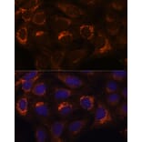 Immunofluorescence - Anti-HIBADH Antibody (A305430) - Antibodies.com