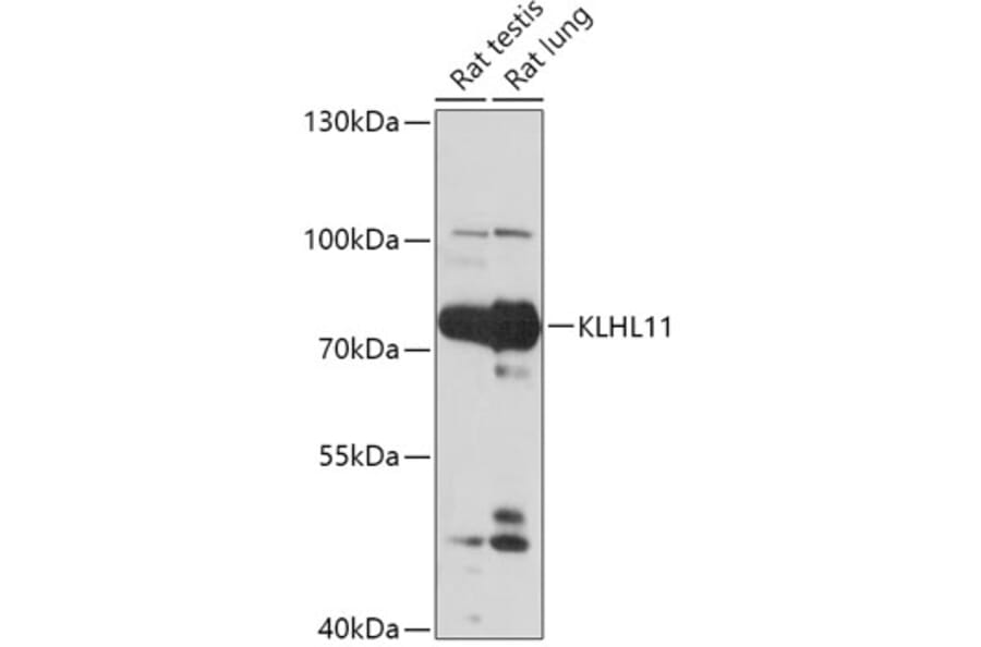 Western Blot - Anti-KLHL11 Antibody (A305431) - Antibodies.com