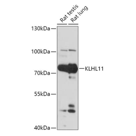 Western Blot - Anti-KLHL11 Antibody (A305431) - Antibodies.com