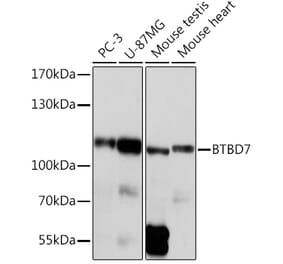 Western Blot - Anti-BTB/POZ domain-containing protein 7 Antibody (A305432) - Antibodies.com