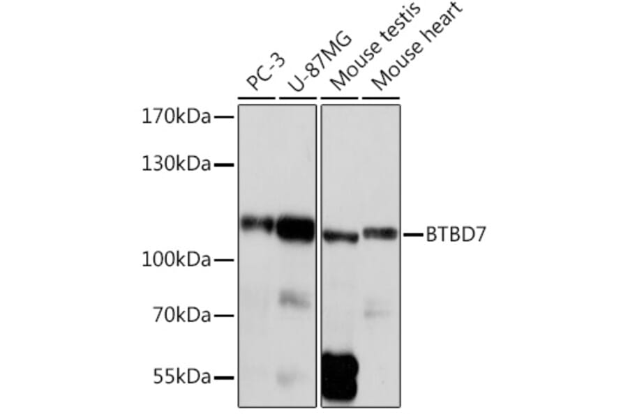 Western Blot - Anti-BTB/POZ domain-containing protein 7 Antibody (A305432) - Antibodies.com
