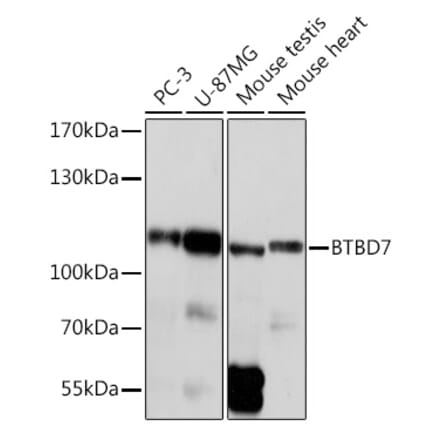 Western Blot - Anti-BTB/POZ domain-containing protein 7 Antibody (A305432) - Antibodies.com