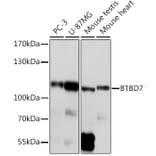 Western Blot - Anti-BTB/POZ domain-containing protein 7 Antibody (A305432) - Antibodies.com