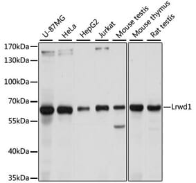 Western Blot - Anti-LRWD1 Antibody (A305433) - Antibodies.com