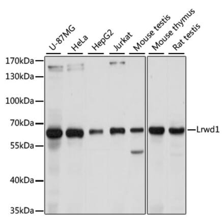 Western Blot - Anti-LRWD1 Antibody (A305433) - Antibodies.com