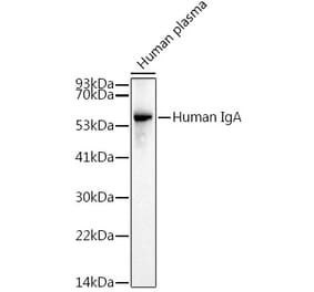 Western Blot - Anti-Human IgA Antibody [ARC2239] (A305435) - Antibodies.com