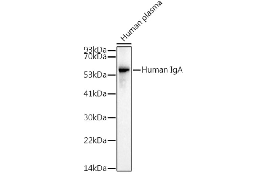 Western Blot - Anti-Human IgA Antibody (A305435) - Antibodies.com