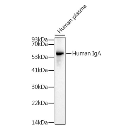 Western Blot - Anti-Human IgA Antibody (A305435) - Antibodies.com