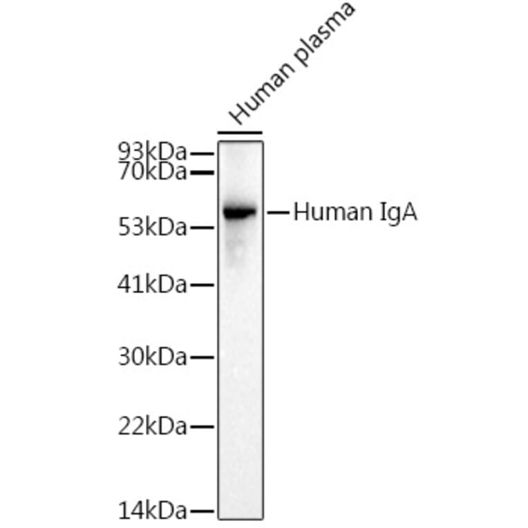 Western Blot - Anti-Human IgA Antibody (A305435) - Antibodies.com
