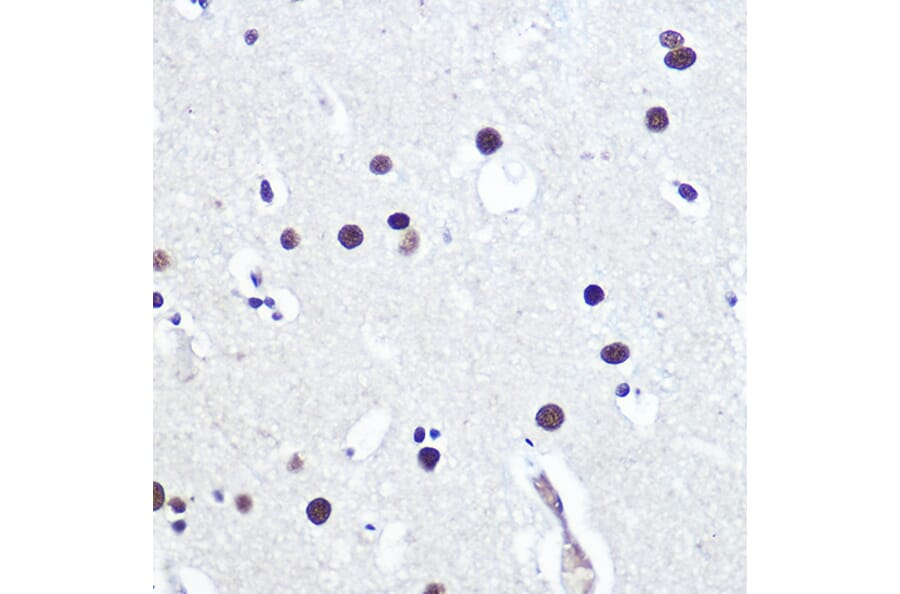 Immunohistochemistry - Anti-53BP1 Antibody (A305436) - Antibodies.com