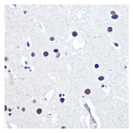 Immunohistochemistry - Anti-53BP1 Antibody (A305436) - Antibodies.com